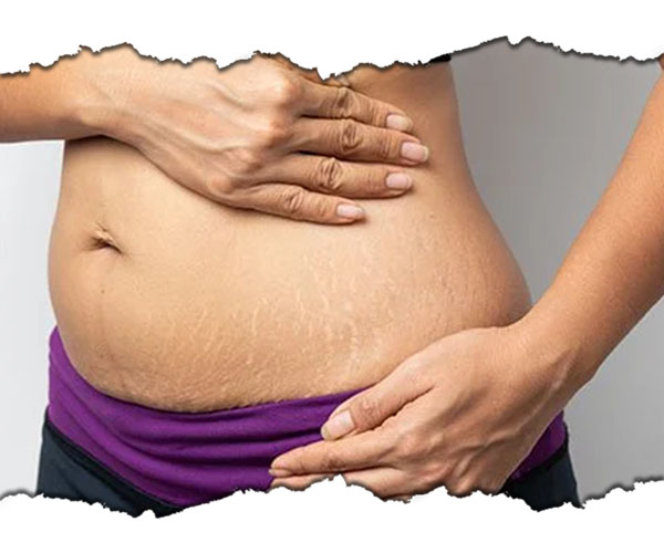 microneedling rejuvenare faciala