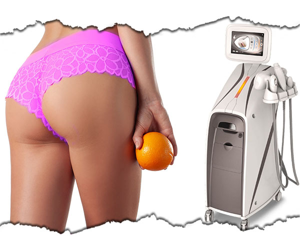 slabire si remodelare corporala