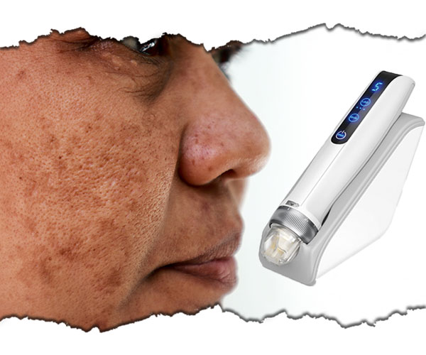 slabire si remodelare corporala