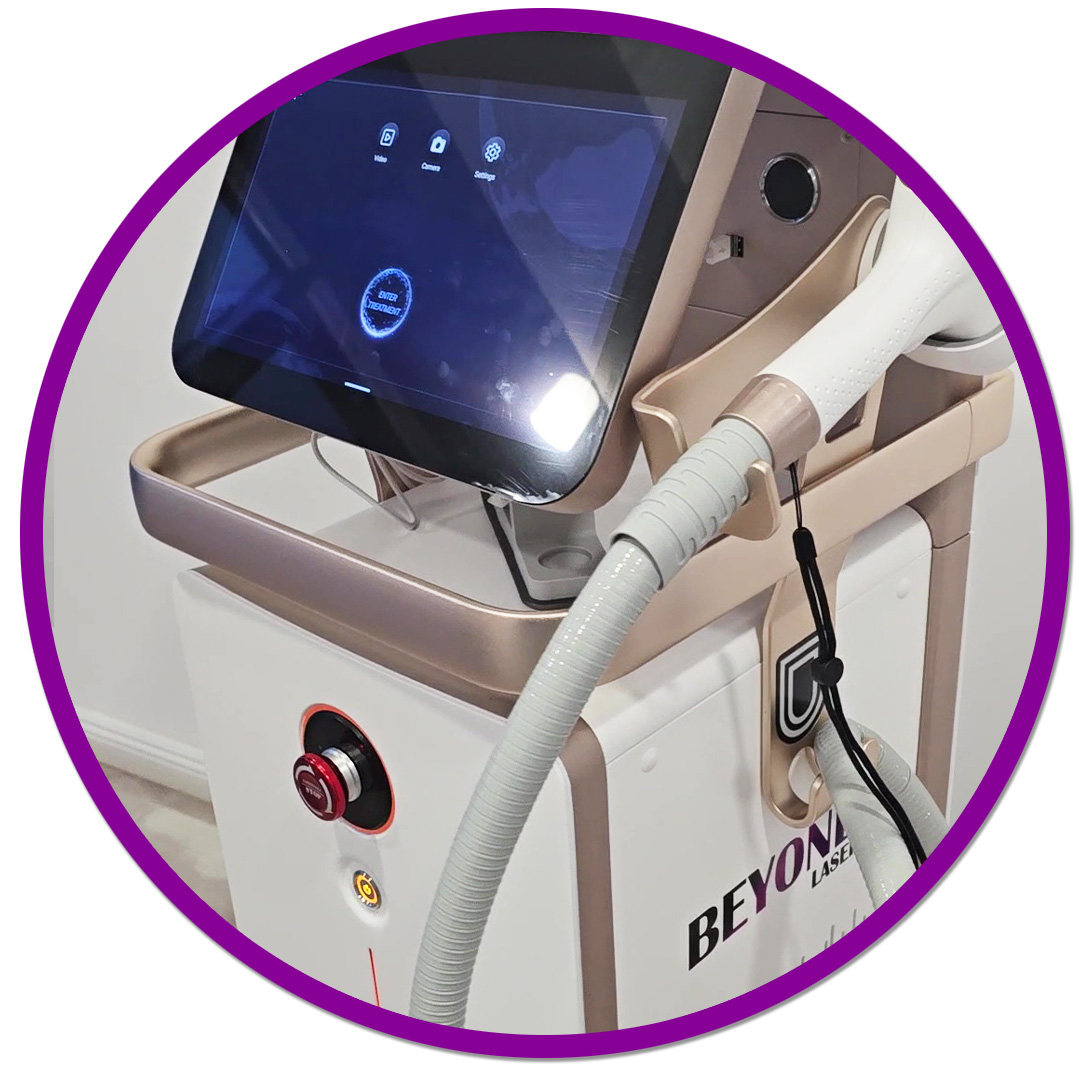 epilare definitivă cu laser în Iași la SenzoFit epilare definitiva cu laser in Iasi